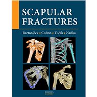 Scapular fractures - Jan Bartoníček; Christopher Colton; Michal Tuček
