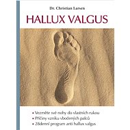 Hallux valgus - Christian Larsen