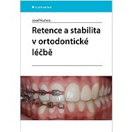 Retence a stabilita v ortodontické léčbě - Josef Kučera