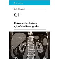 CT: Průvodce technikou výpočetní tomografie - 