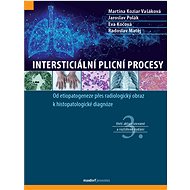 Intersticiální plicní procesy - Martina Vašáková; Jaroslav Polák; Radoslav Matěj