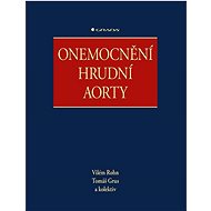 Onemocnění hrudní aorty - 
