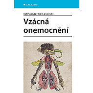 Vzácná onemocnění - Kateřina Kopečková