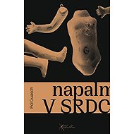 Napalm v srdci - 