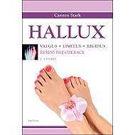 Hallux: Řešení bez operace - Carsten Stark