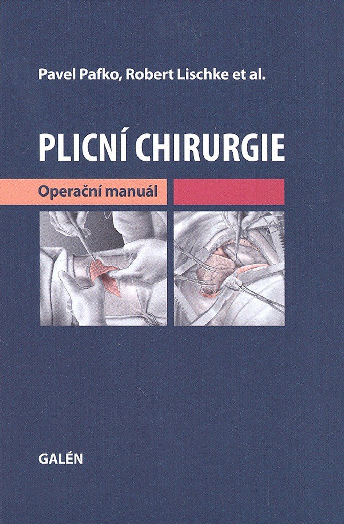 Plicní chirurgie: Operační manuál - 