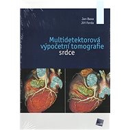 Multidetektorová výpočetní tomografie srdce - Jan Baxa; Jiří Ferda