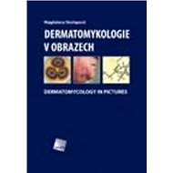 Dermatomykologie v obrazech - Magdalena Skořepová