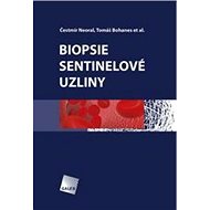 Biopsie sentinelové uzliny - Čestmír Neoral; Tomáš Bohanes