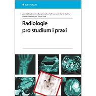 Radiologie pro studium i praxi - Zdeněk Seidl; Andrea Burgetová; Eva Hoffmannová; Martin Mašek; Manuela Vaněčk...
