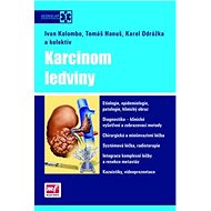 Karcinom ledviny - Ivan Kolombo; Tomáš Hanuš; Karel Odrážka