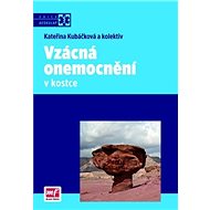 Vzácná onemocnění v kostce - Kateřina Kubáčková