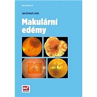 Makulární edémy - Jan Ernest