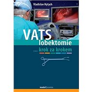 VATS lobektomie: ...krok za krokem - Vladislav Hytych