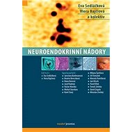 Neuroendokrinní nádory - Eva Sedláčková; Viera Bajčiová