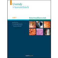 Uveitidy - Petra Svozílková