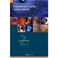 Diagnostika a léčba očních zánětů - Petra Svozílková