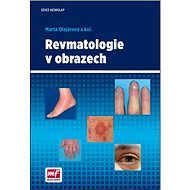 Revmatologie v obrazech - Marta Olejárová