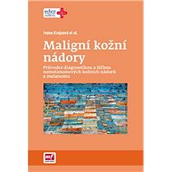 Maligní kožní nádory - Ivana Krajsová
