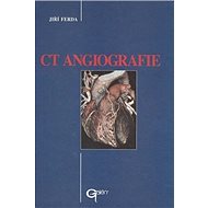 CT Angiografie - Jiří Ferda