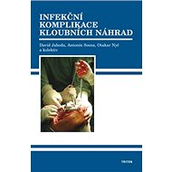 Infekční komplikace kloubních náhrad - David Jahoda