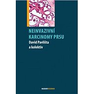 Neinvazivní karcinomy prsu - David Pavlišta