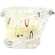 Verk 01964 Model of dental implants white - Educational Toy