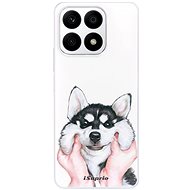 iSaprio Malamute 01 pro Honor X8a - Phone Cover