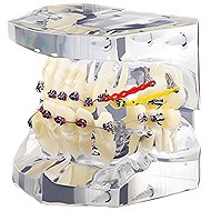 Verk 27403 Orthodontic model of teeth - Anatomy Model