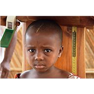 Fighting Child Malnutrition - Charity Project