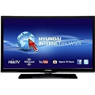 24" Hyundai HL 24382 SMART - Television