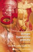 Benigní hyperplazie prostaty - rady pacientům - Elektronická kniha - Hlavní obrázek