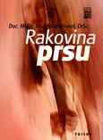 Rakovina prsu - Elektronická kniha