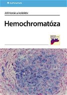 Hemochromatóza - Elektronická kniha