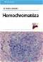 Hemochromatóza - E-kniha