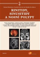 Rinitidy, sinusitidy a nosní polypy - Elektronická kniha