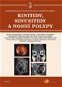 Rinitidy, sinusitidy a nosní polypy - E-kniha