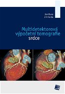 Multidetektorová výpočetní tomografie srdce - E-kniha
