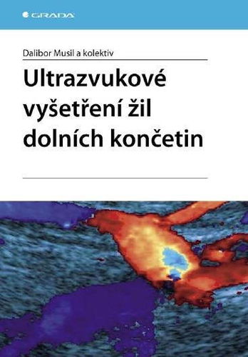 Ultrazvukové vyšetření žil dolních končetin - Elektronická kniha - Hlavní obrázek
