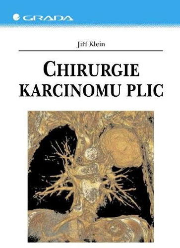 Chirurgie karcinomu plic - Elektronická kniha - Hlavní obrázek