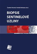 Biopsie sentinelové uzliny - Elektronická kniha