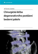 Chirurgická léčba degenerativního postižení bederní páteře - Elektronická kniha