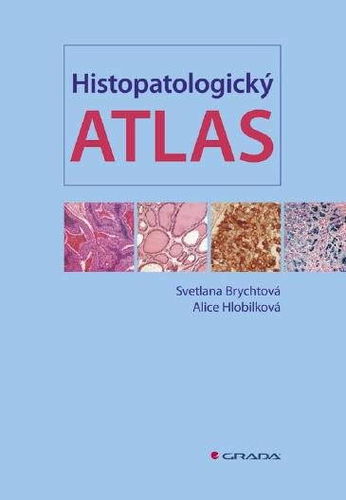 Histopatologický atlas - Elektronická kniha - Hlavní obrázek