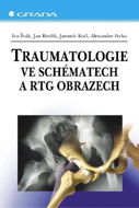 Traumatologie ve schématech a RTG obrazech - Elektronická kniha