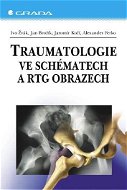 Traumatologie ve schématech a RTG obrazech - Alexander Ferko