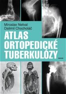 Atlas ortopedické tuberkulózy - Elektronická kniha