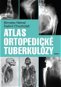 Atlas ortopedické tuberkulózy - Elektronická kniha