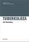 Tuberkulóza - Elektronická kniha