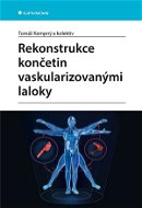 Rekonstrukce končetin vaskularizovanými laloky - Elektronická kniha