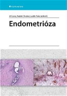 Endometrióza - Elektronická kniha